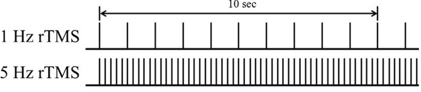 pulsos de alta frecuencia en Estimulación Magnética Transcraneal